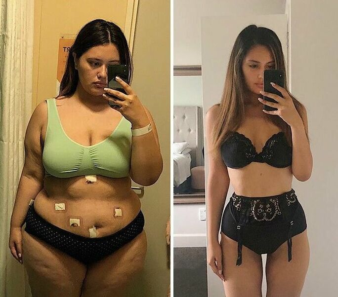 Дівчина до і після схуднення з капсулами KETO Complete